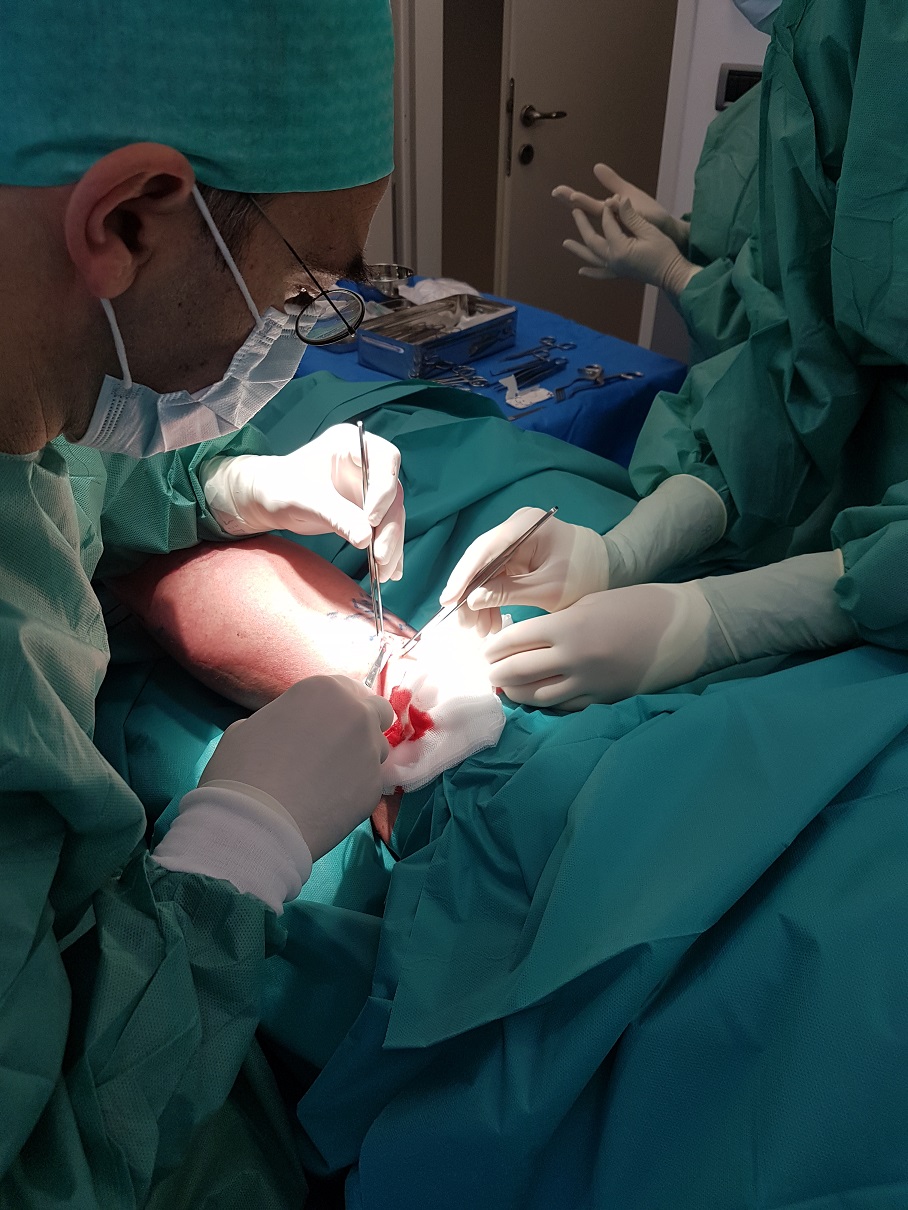 Operater Matej Makovec operira krčne žile.
